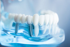 INKA Dentallabor GmbH & Co. Zahntechnik KG  